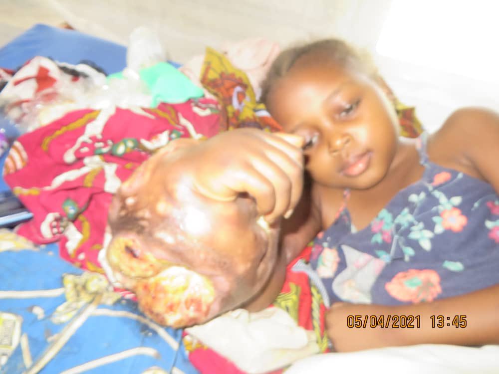 RDC: La Fondation Henriette Wamu fait appel aux personnes de bonne volonté pour un accompagnement et sauver la petite Rebecca