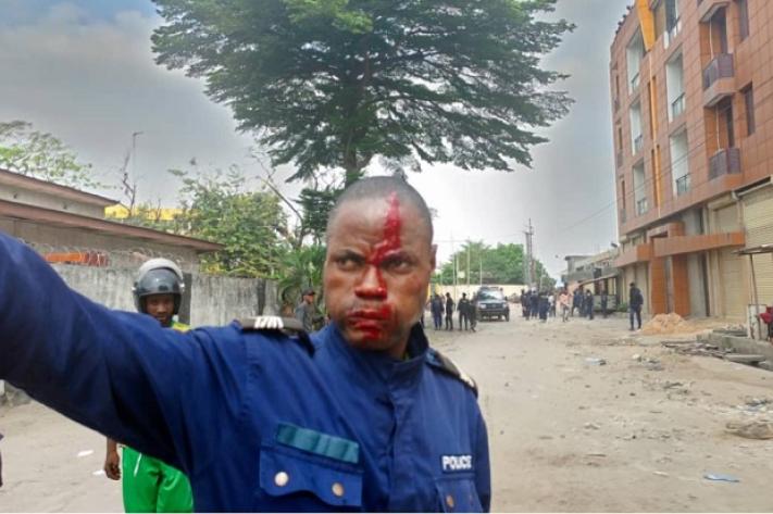 Troubles à l’ISTA : au moins 9 policiers blessés