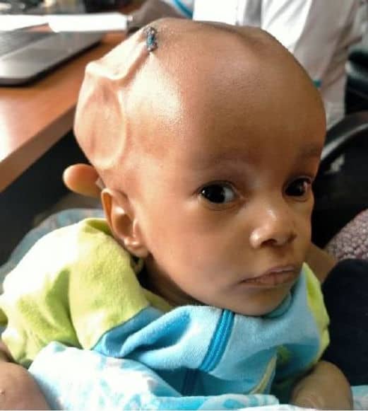 RDC-Santé : la cérémonie de présentation des actions de l’Asbl Winner dans le domaine de la Santé